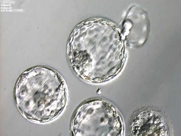 囊胚移植后1到20天变化图分享，着床全过程看这就知道