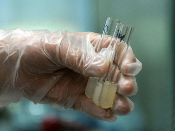 精浆生化报告单主要看这四项指标，精浆锌是否正常很关键