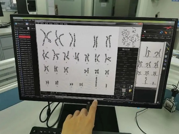 梳理染色体倒位和易位的3大区别，哪个严重看这里就知道