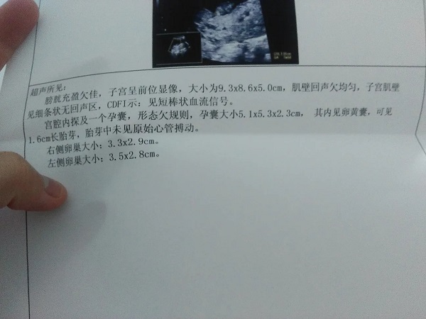 胎芽看是男孩女孩有方法，长得快慢or长短预示不同性别