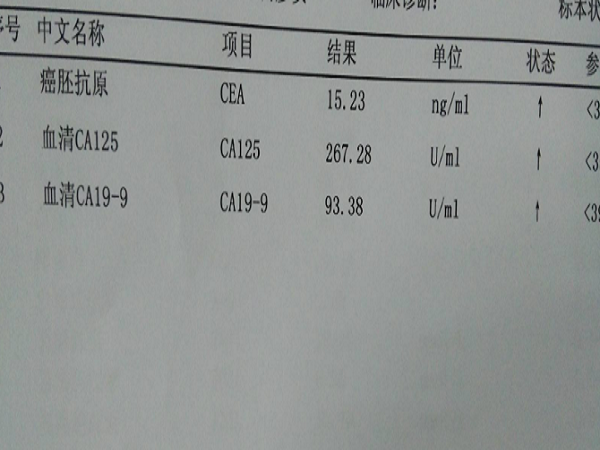 试管移植前ca125偏高要警惕，可不仅仅是影响着床的几率