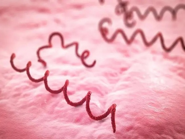 梅毒怀孕生下孩子的案例分享，坚持做阻断可降低传染概率