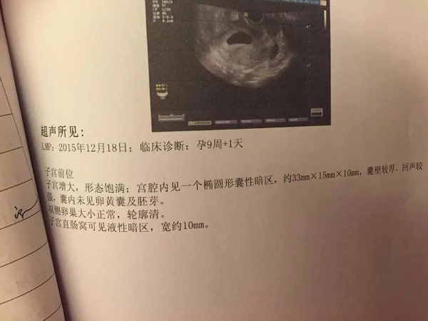 空囊90天保胎成功经验不可信，强行保胎后果严重要注意