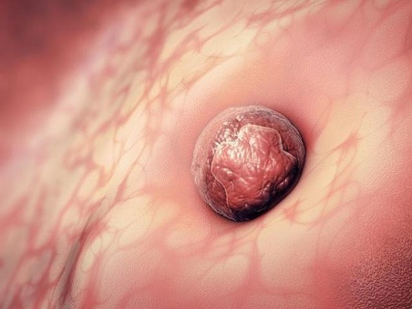 试管移植后喝中药帮助着床有用，这些方子效果好别错过！