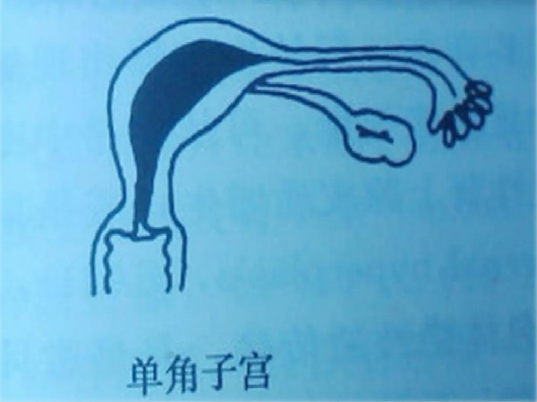 单角子宫试管双胎经验分享：这些成功小窍门千万别错过