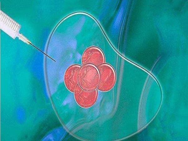 解读微刺激方案的详细流程，什么时候移植冻胚一清二楚