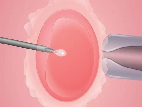 试管前需空腹的检查项目可不少，性激素六项只是其中一项