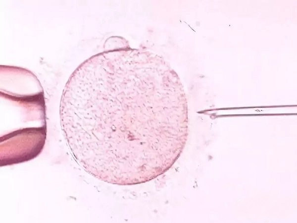 试管移植2次都失败的原因分析，心理素质差成功率自然低