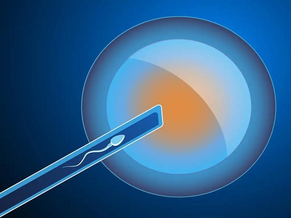 上班族做试管请假攻略分享：找什么理由合适看这就知道