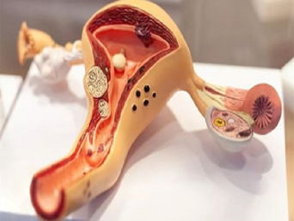 巧囊试管一次成功的经验分享，不手术做好这些受孕真不难