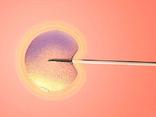 遵义做试管婴儿的价格表一览，一个周期需多少钱心中有数