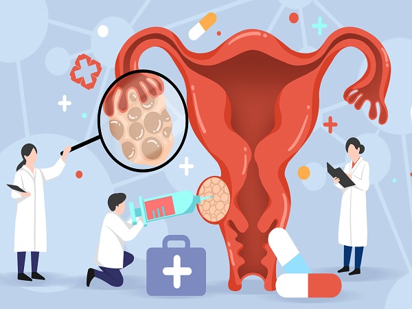 解读三代试管取完卵的下一步，多久去医院移植因人而异