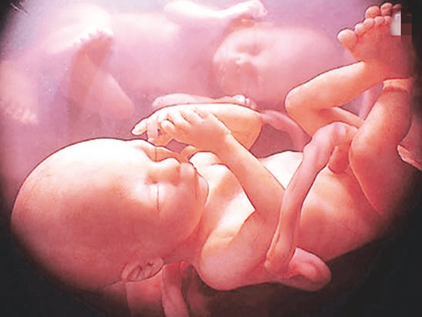 怀双胞胎真没想象中那么好，这个月份又累又难熬别不知道