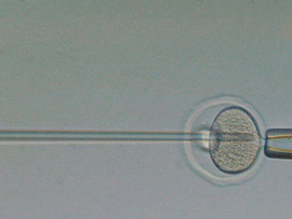 三代试管第二次促排收费标准一览，需要加多少钱不再纠结