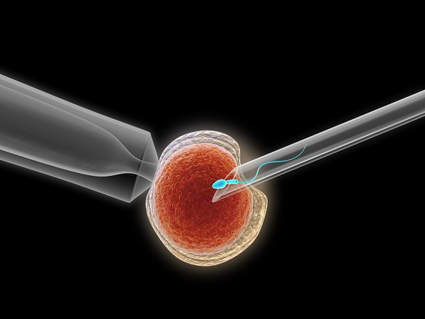 试管婴儿取卵无痛费用明细，和有痛费用相差多少一清二楚