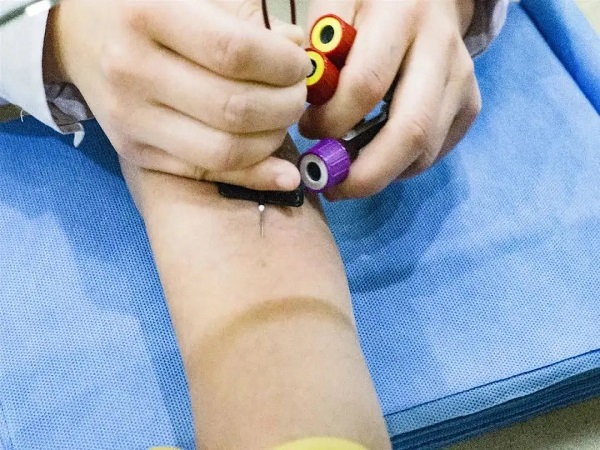 试管移植后d2聚体的正常值一览，超过这个范围就要注意了