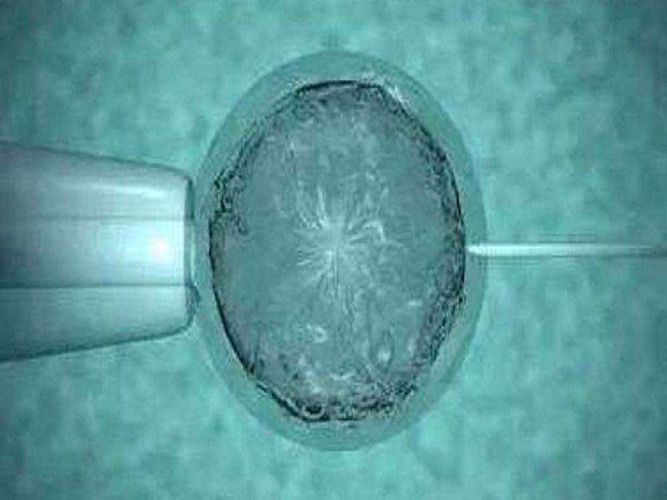 解读一代试管流程：从检查到移植需要多长时间一目了然