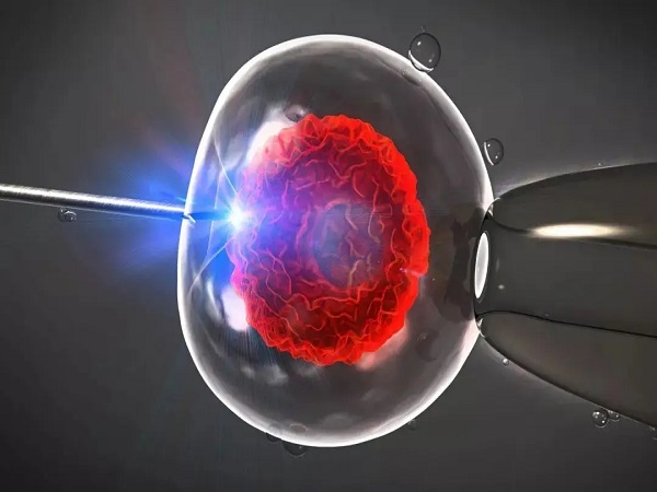 咨询试管婴儿应该问的问题整理，这5个必问你不可不知