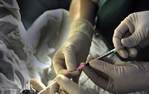 俄罗斯试管婴儿取卵真的很痛吗？