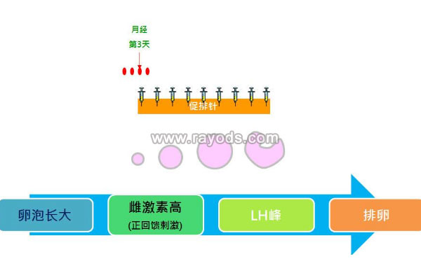 泰国试管婴儿促排卵方案的优缺点与适用人群