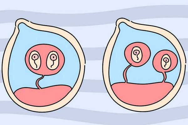 泰国拍耶泰2医院揭露“黑中介”试管生龙凤胎谣言