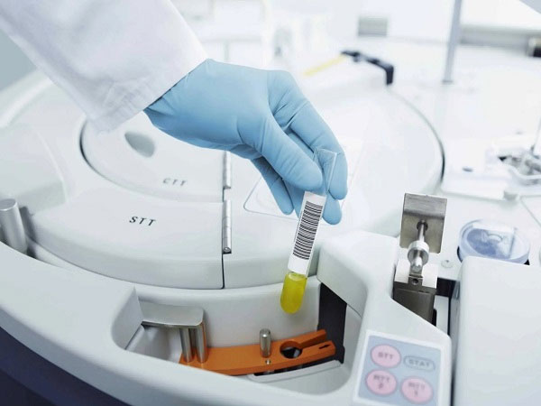 第二代试管是否一定要做羊穿?为啥不少过来人都建议做