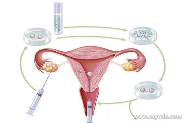 贺美奇以前没听说过，这个药是国产还是进口？