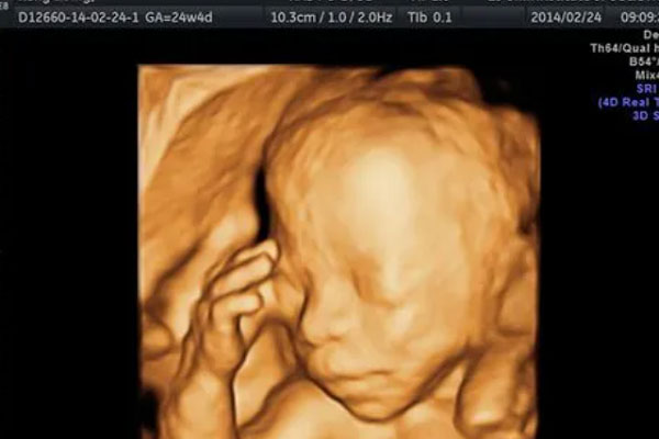 B超四维一看面相就是男孩？附男宝脸型参照图