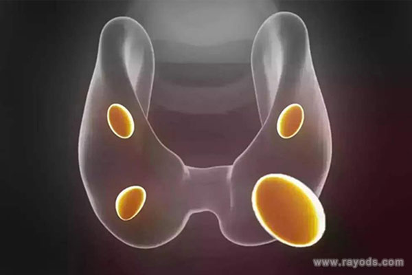 卵泡不破是什么原因引起的-看了这篇文章终于知道了