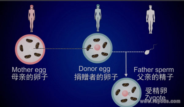 第四代试管婴儿技术_名词释义