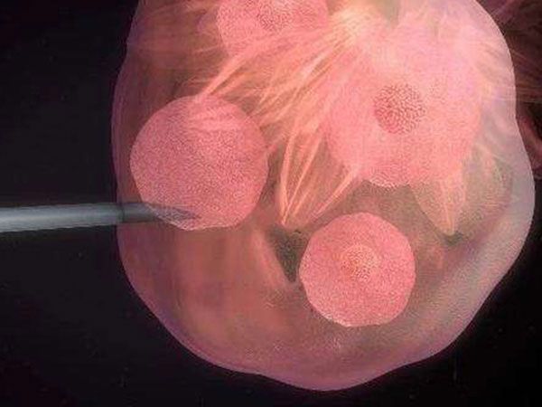国内找供卵中介机构做三代试管如何避坑？