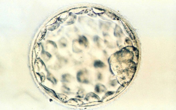 移植前鲜胚养囊过程中4aa级别的囊胚非常少见吗？
