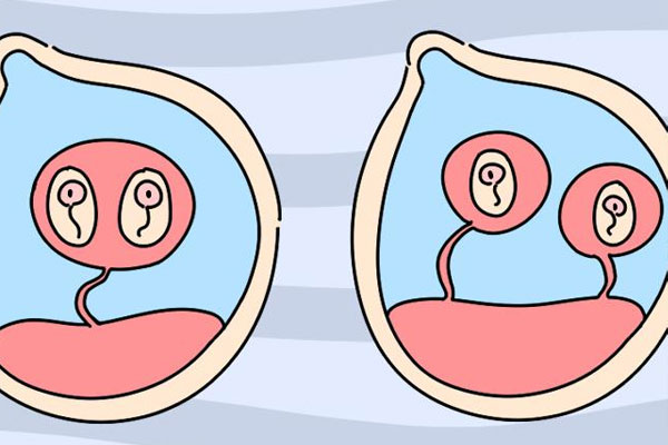 试管移植后真不需要天天躺着，长期卧床反而有这3大坏处