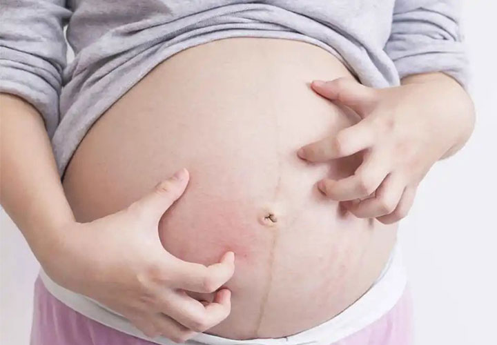 怀孕5个月后平躺看肚子中线怎么判断生男生女，有图解吗？