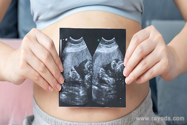 刚怀上双胞胎有什么征兆?体重增加快能证明吗?