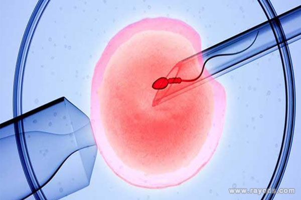 第二代试管婴儿-ICSI的成功率大概是多少