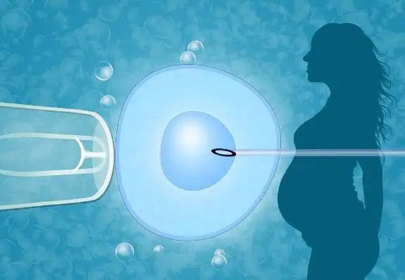 不孕症ivf-et手术是什么意思？是第几代试管婴儿技术？