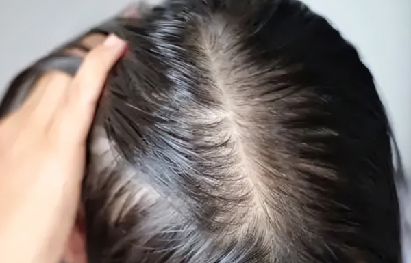 怀女孩头发的变化一览，怀孕后头发不油了是明显特征