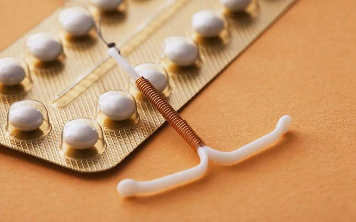 爱母节育环怎么样？多久换一次？