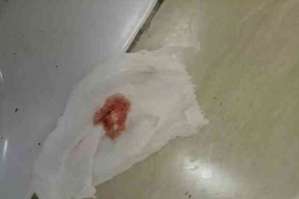 纸上的血可以做亲子鉴定的样本吗？