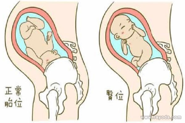 八个月大臀位的胎儿在肚子里面一般是什么姿势？
