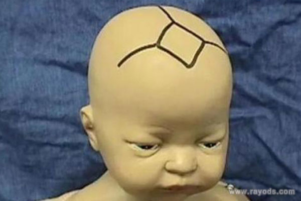 宝宝出生后0~18月囟门大小正常值是多少？