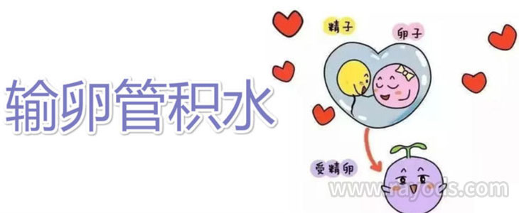 乌克兰试管婴儿输卵管积水怎么办？这样做轻松解决！