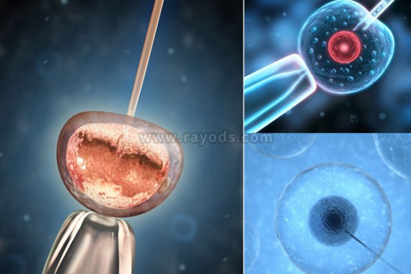 香港姐妹分享试管婴儿寿命和正常孩子一样吗？
