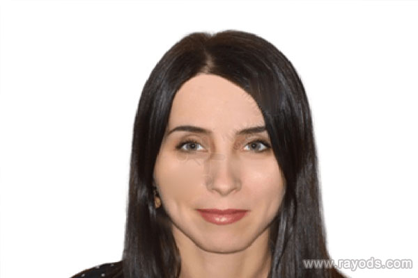 乌克兰Wisedoc诊所金牌医生推荐，特罗希莫诺维奇博士