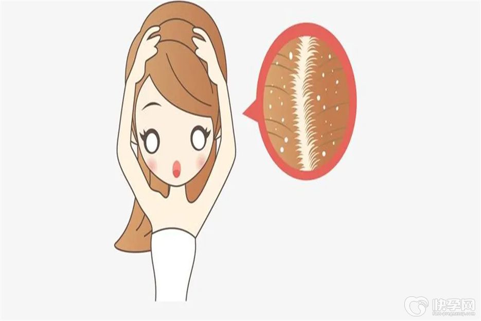 重点公布：5分钟去屑小妙招，让头发柔顺飘逸