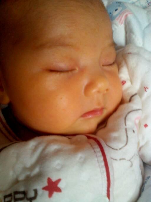 小儿黄疸怎么退比较快（母乳性黄疸一般黄哪里）