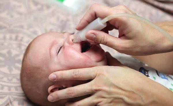 宝宝鼻子不通气怎么办速效办法（婴儿鼻子不通气怎么办速效办