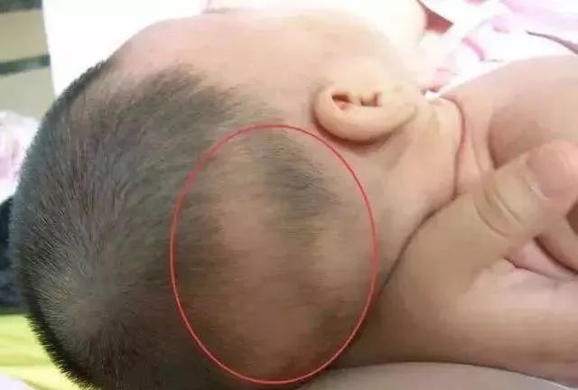 婴儿头发偏黄是缺什么（头发发黄怎么改善）