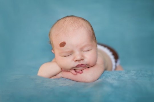 最有福气的10处胎记 宝妈们快来看看你家孩子中没中